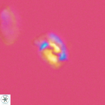 Helicosphaerella philippinensis VR 09847