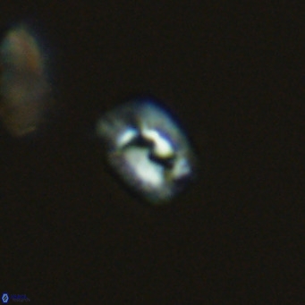 Helicosphaerella philippinensis VR 09848