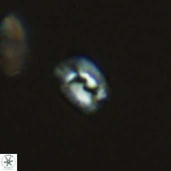 Helicosphaerella philippinensis VR 09848