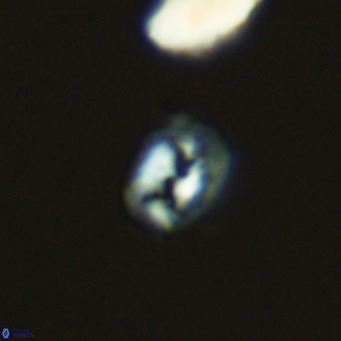 Helicosphaerella philippinensis VR 09840