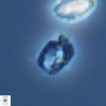 Helicosphaerella philippinensis VR 09858