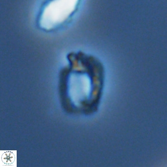 Helicosphaerella philippinensis VR 09859