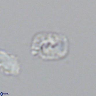 Helicosphaerella philippinensis VR 09851