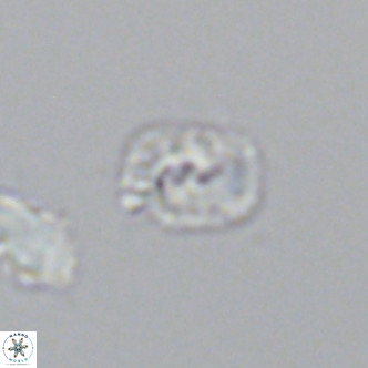 Helicosphaerella philippinensis VR 09851
