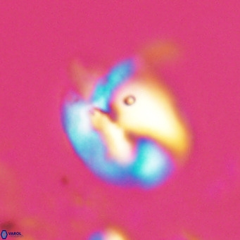 Helicosphaerella recta VR 024598