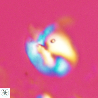 Helicosphaerella recta VR 024598