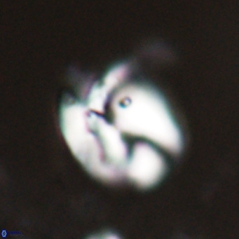 Helicosphaerella recta VR 024599