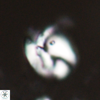 Helicosphaerella recta VR 024599