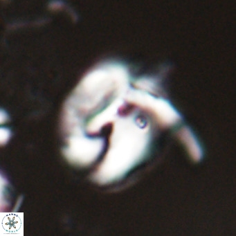 Helicosphaerella recta VR 024604