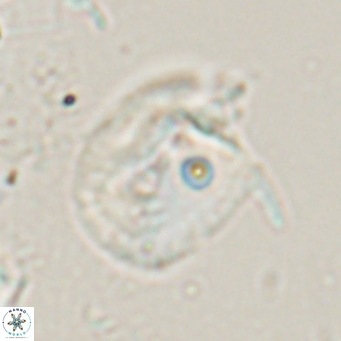 Helicosphaerella recta VR 024606