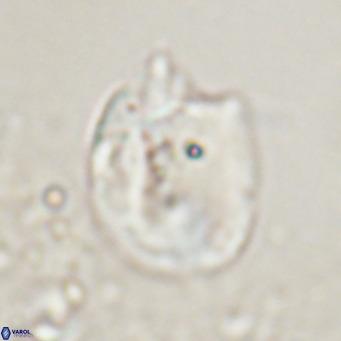 Helicosphaerella recta VR 024607