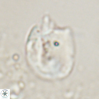 Helicosphaerella recta VR 024607