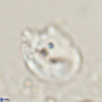 Helicosphaerella recta VR 024608