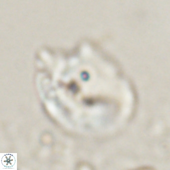 Helicosphaerella recta VR 024608