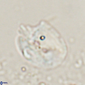 Helicosphaerella recta VR 024609