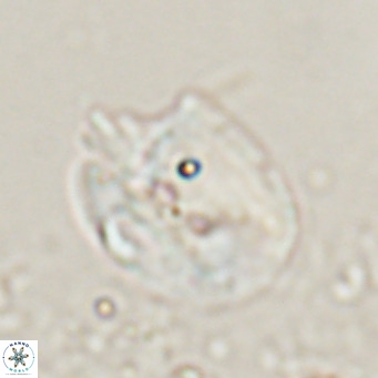Helicosphaerella recta VR 024609