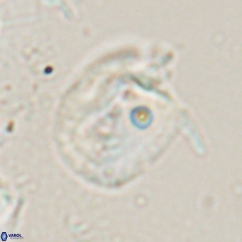 Helicosphaerella recta VR 024610