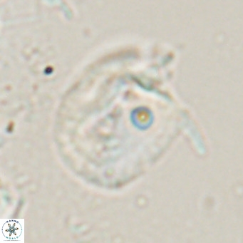 Helicosphaerella recta VR 024610