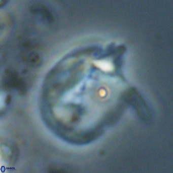 Helicosphaerella recta VR 024611