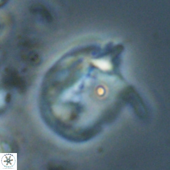 Helicosphaerella recta VR 024611