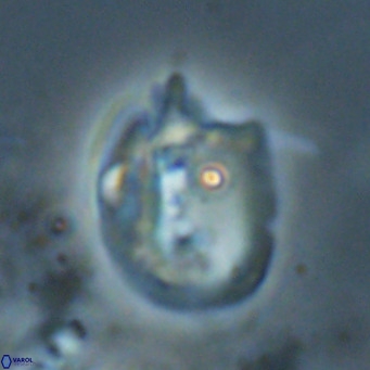 Helicosphaerella recta VR 024612