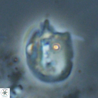 Helicosphaerella recta VR 024612