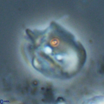 Helicosphaerella recta VR 024613