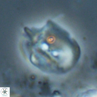 Helicosphaerella recta VR 024613