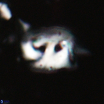 Helicosphaerella recta VR 028499