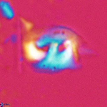 Helicosphaerella recta VR 028500