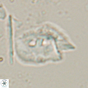 Helicosphaerella recta VR 028501