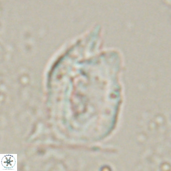 Helicosphaerella recta VR 028505