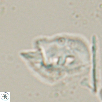 Helicosphaerella recta VR 028507