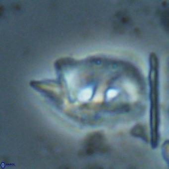 Helicosphaerella recta VR 028508