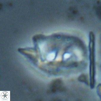 Helicosphaerella recta VR 028508