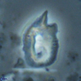 Helicosphaerella recta VR 028510