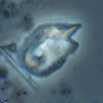 Helicosphaerella recta VR 028511