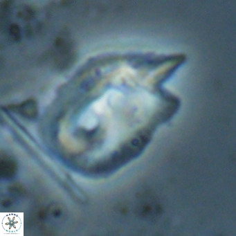 Helicosphaerella recta VR 028511