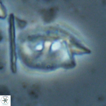 Helicosphaerella recta VR 028512