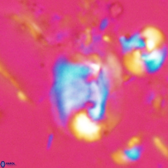 Helicosphaerella recta VR 028694