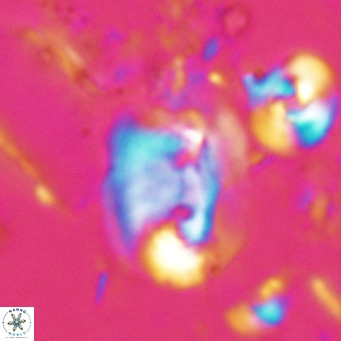 Helicosphaerella recta VR 028694