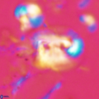Helicosphaerella recta VR 028699