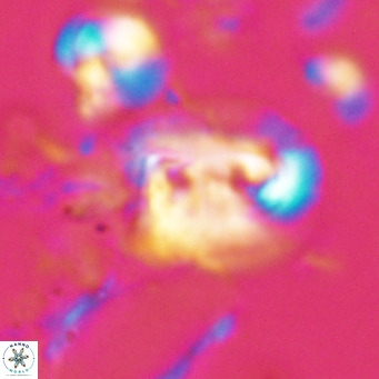 Helicosphaerella recta VR 028699