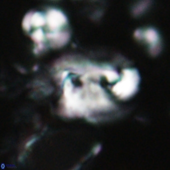 Helicosphaerella recta VR 028700