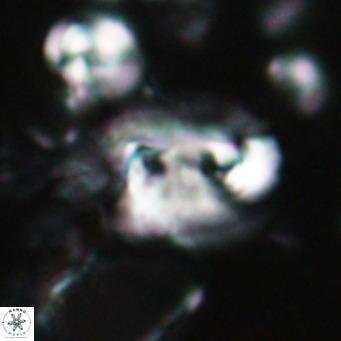 Helicosphaerella recta VR 028700