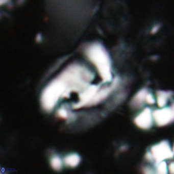 Helicosphaerella recta VR 028701