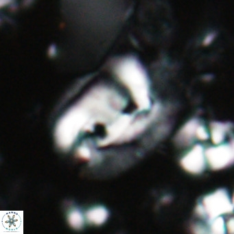 Helicosphaerella recta VR 028701