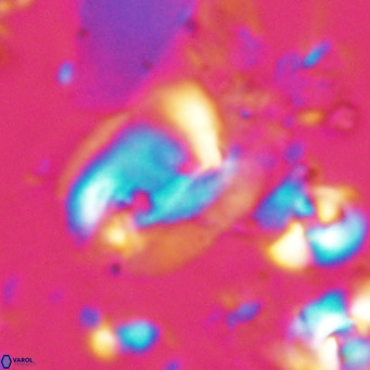 Helicosphaerella recta VR 028702