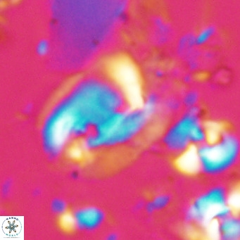 Helicosphaerella recta VR 028702