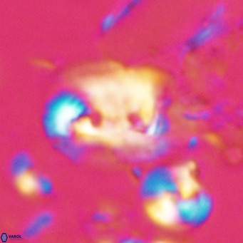 Helicosphaerella recta VR 028703